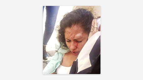 Agreden a una asambleísta boliviana cerca de la Gobernación de Santa Cruz (FOTOS, VIDEO)