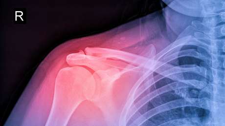 Realizan el primer trasplante de médula ósea en animales para reparar un hueso roto en Irán