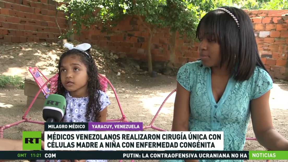 Médicos venezolanos realizan una cirugía única con células madre a niña con una enfermedad congénita