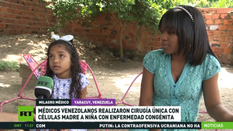 Médicos venezolanos realizan una cirugía única con células madre a niña con una enfermedad congénita