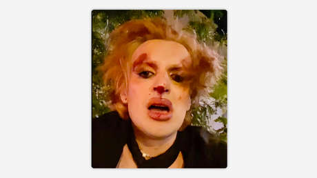 Agreden a una militar trans en el oeste de Ucrania adonde llegó para enterrar a su madre (VIDEO)