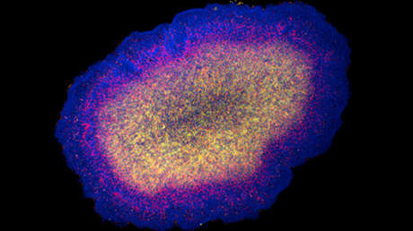 Una antigua criatura marina del tamaño de un grano de arena podría revelar el origen de las neuronas