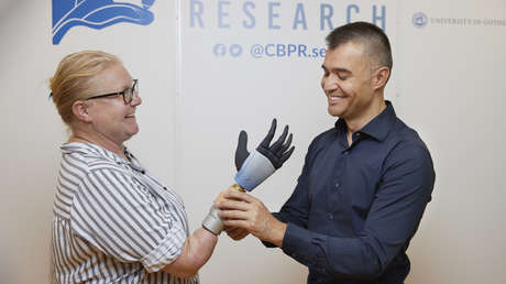 Acoplan una revolucionaria mano biónica con inteligencia artificial a los huesos, músculos y nervios de una mujer