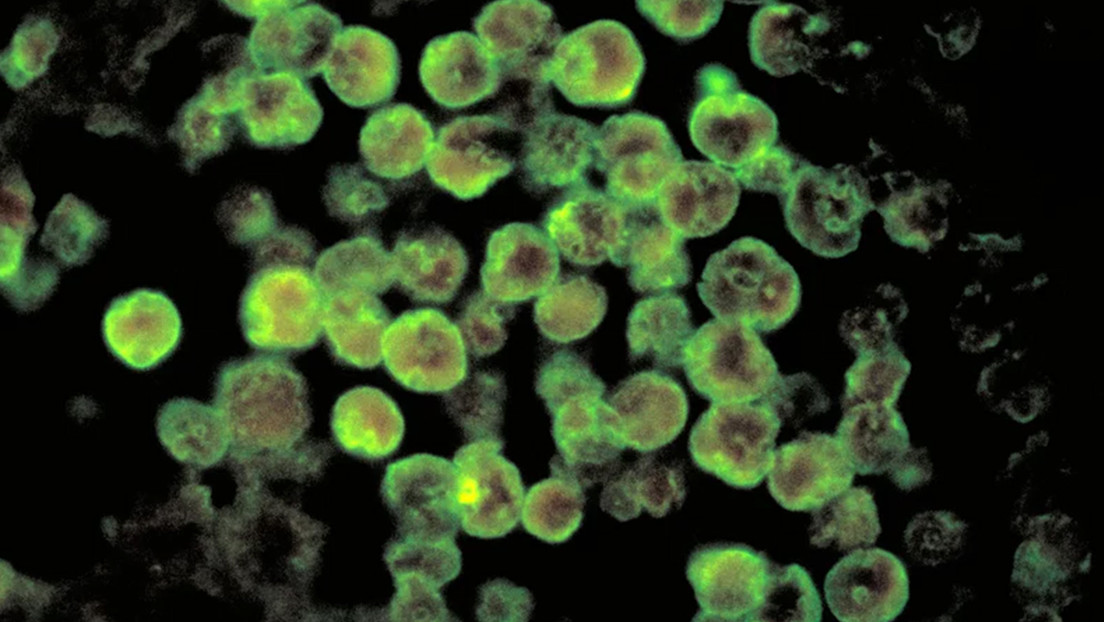 Revelan detalles sobre el caso de la 'ameba comecerebros' que causó muerte de una niña en Colombia