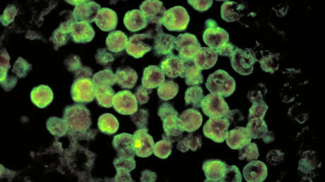 Revelan detalles sobre el caso de la 'ameba comecerebros' que causó muerte de una niña en Colombia