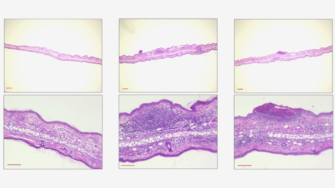 Un parásito tropical deformante podría contener un secreto esencial para el desarrollo de nuevos analgésicos