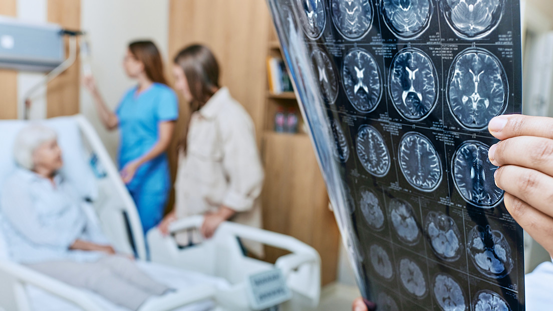 Descubren que un tratamiento médico obsoleto pudo causar transmisión de alzhéimer