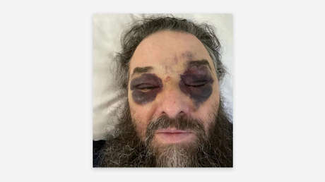 Clérigo ortodoxo sufre violenta agresión en Ucrania