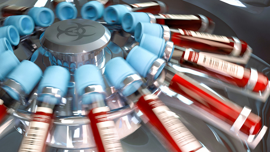 Varias personas contrajeron VIH a través del 'vampiro facial' en EE.UU.