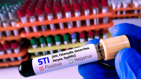 Una de las enfermedades de transmisión sexual más antiguas aumenta su impacto en EE.UU.