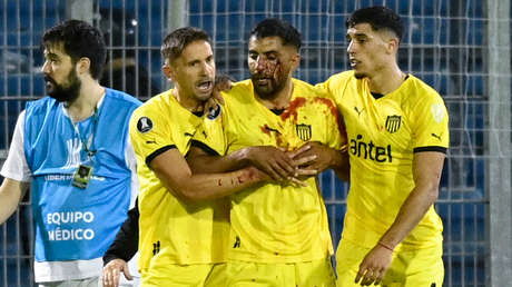VIDEO: Fuerte pedrada en la cara deja sangrado a un futbolista en un partido de Copa Libertadores