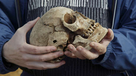 Descubren una prótesis única de hace 300 años, hecha de oro, cobre y lana