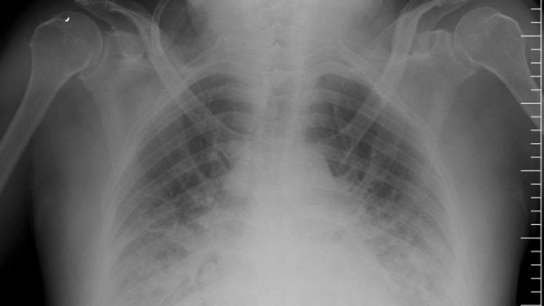 Sufre un fallo multiorgánico tras un ataque "masivo" de abejas