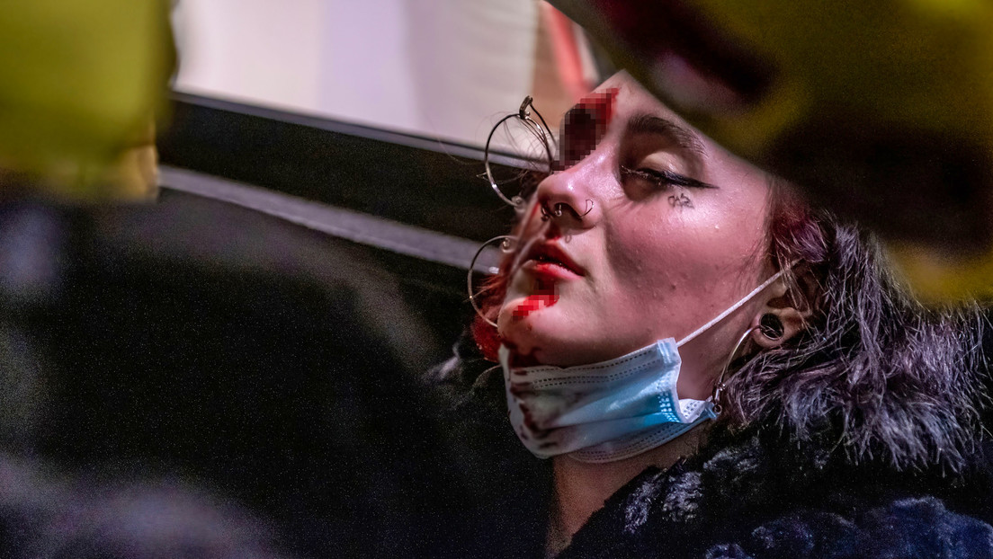 Mujer pierde el ojo por un disparo policial en España y archivan la causa con un insólito argumento