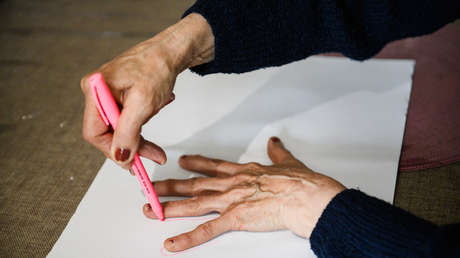 Identifican una nueva forma de alzhéimer