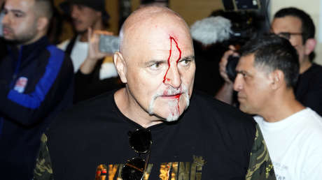 John Fury propina un brutal cabezazo a un miembro del equipo de Oleksandr Usyk