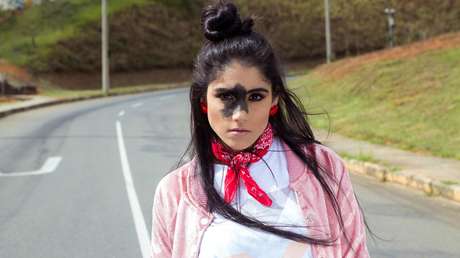 Una modelo brasileña rompe moldes con una mancha que le cubre parte del rostro