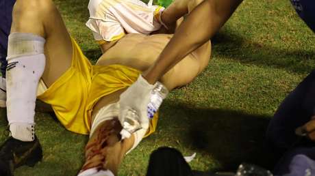 Un policía dispara en la pierna a un portero durante un partido (VIDEO)