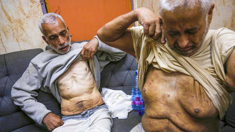 Amnistía Internacional: 27 palestinos liberados fueron torturados en Israel