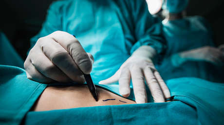 Suplantación, estafa y lesiones a mujeres: El caso de la 'Reina de la cirugía' en España