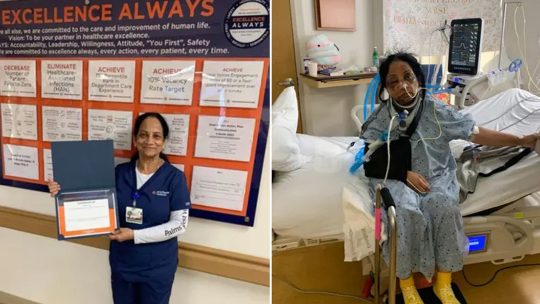 Cara desfigurada e insultos racistas: el brutal ataque de paciente a una enfermera en EE.UU.