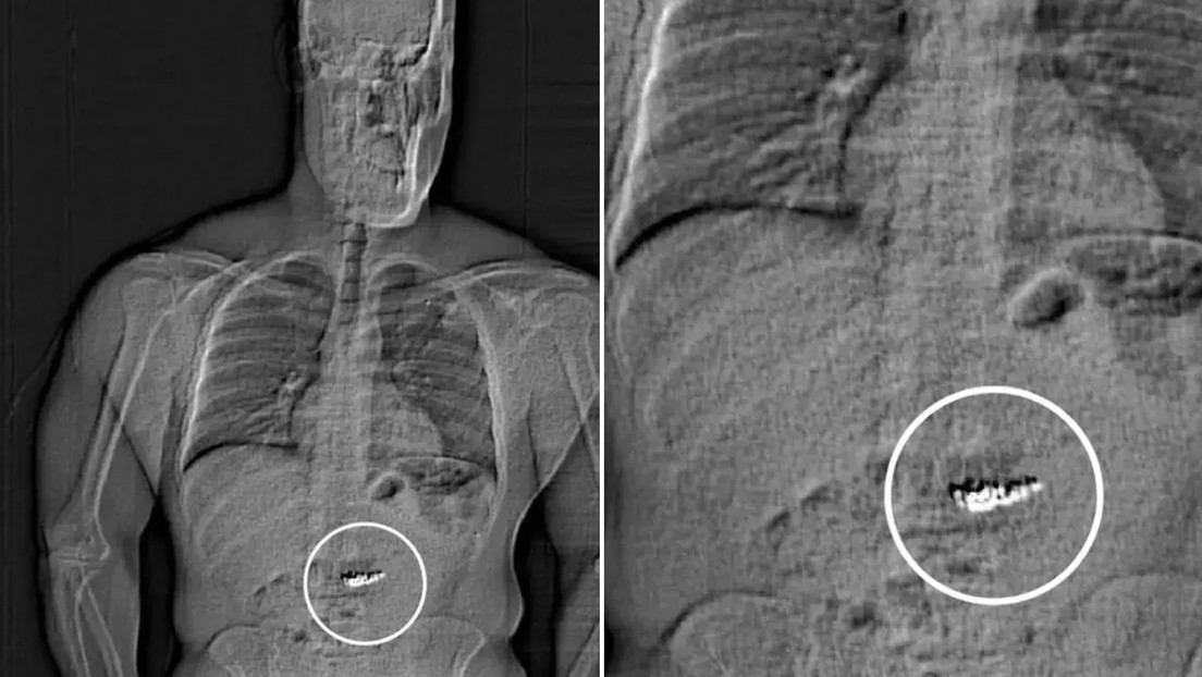 Un ladrón se tragó pendientes de diamantes de 770.000 dólares