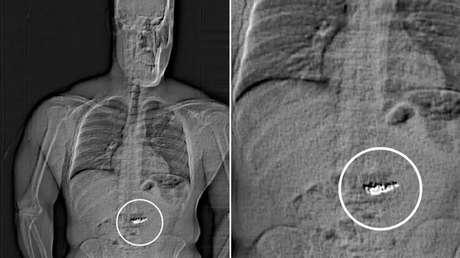 Un ladrón se tragó pendientes de diamantes de 770.000 dólares
