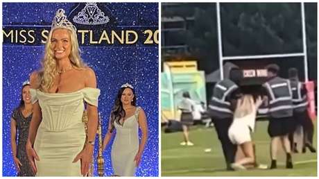 "Mordió el brazo": Revelan detalles del escándalo protagonizado por una reina de belleza