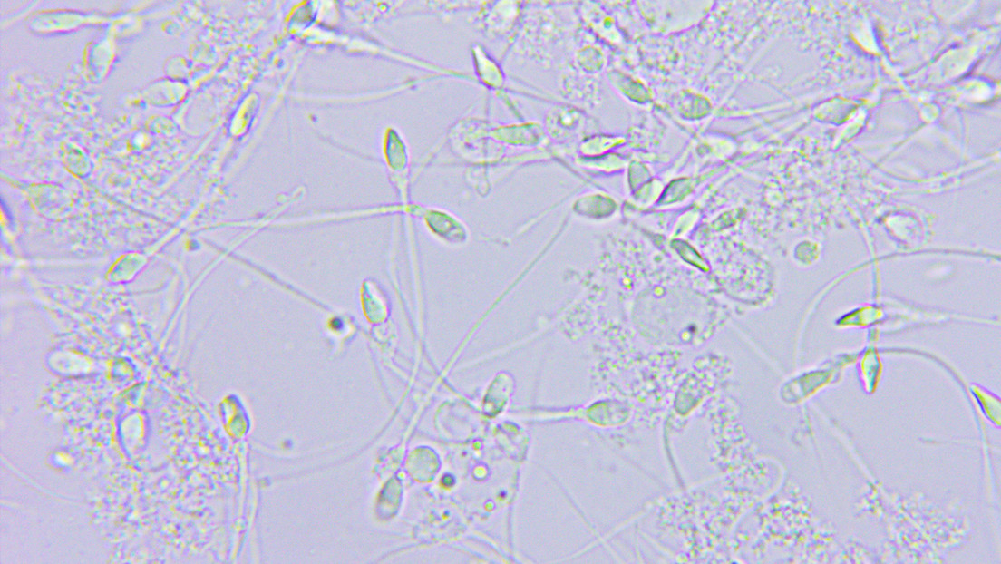 Arranca la cuenta atrás hacia la primera carrera de espermatozoides