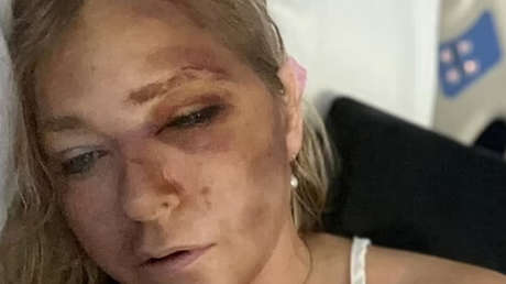 Surgen detalles del accidente de tráfico de una víctima de Epstein que dijo que le quedaban "días" de vida