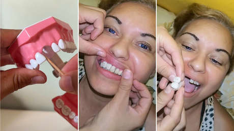 Dientes por TikTok: la peligrosa 'moda' que pone en alerta a Brasil