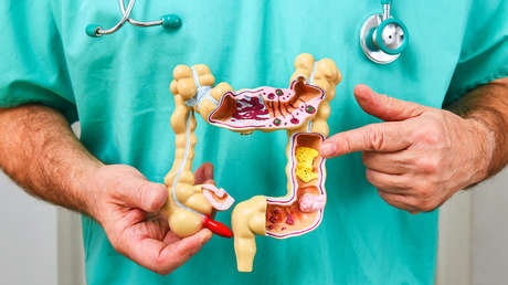 Este el posible 'culpable' del alarmante aumento de cáncer de colon en jóvenes