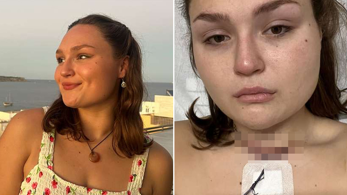 Desarrolla un síntoma inusual durante las vacaciones y resulta ser un cáncer agresivo