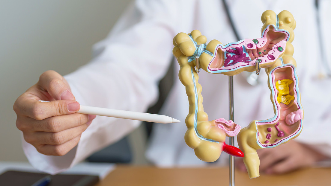 Estos sencillos cambios en la dieta reducen el riesgo de cáncer de colon