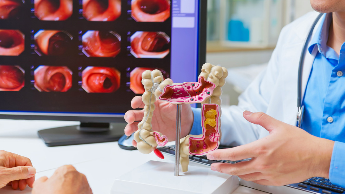 La pérdida de esta proteína podría provocar cáncer de colon