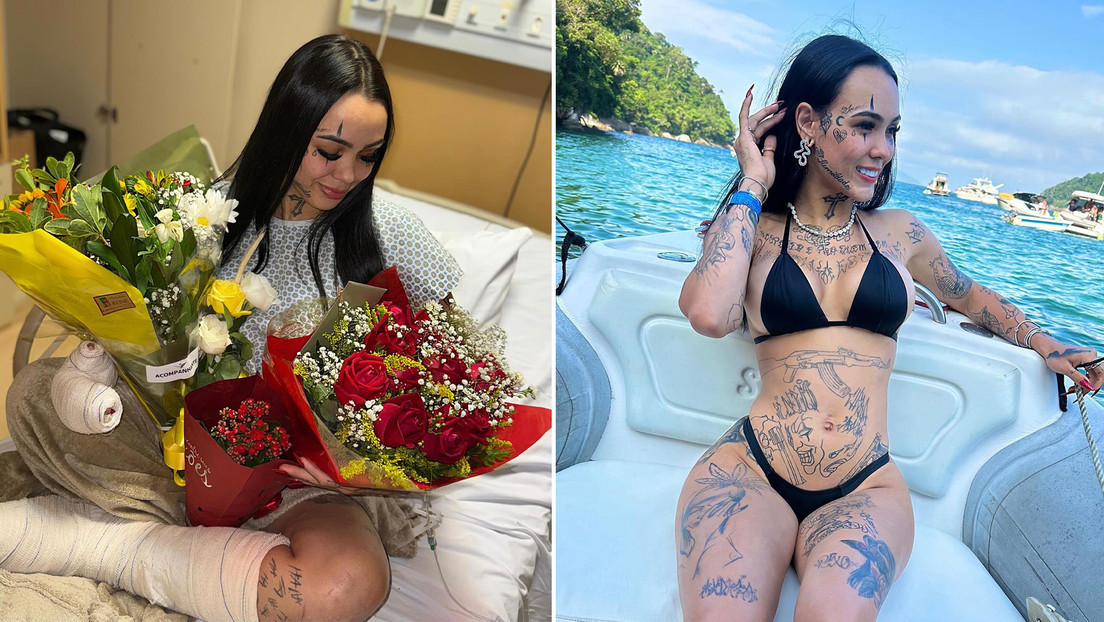 'Influencer' brasileña sufre brutal ataque de su ex y muestra sus heridas en vivo