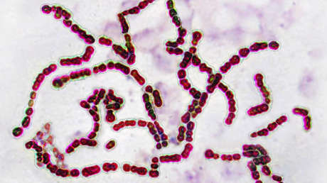 "Una pandemia a simple vista": Alertan sobre el aumento de los casos de esta letal bacteria