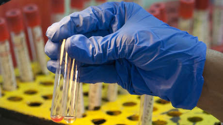 Contagios con hepatitis por transfusión de sangre: el escándalo que afectará a 400.000 personas en Reino Unido