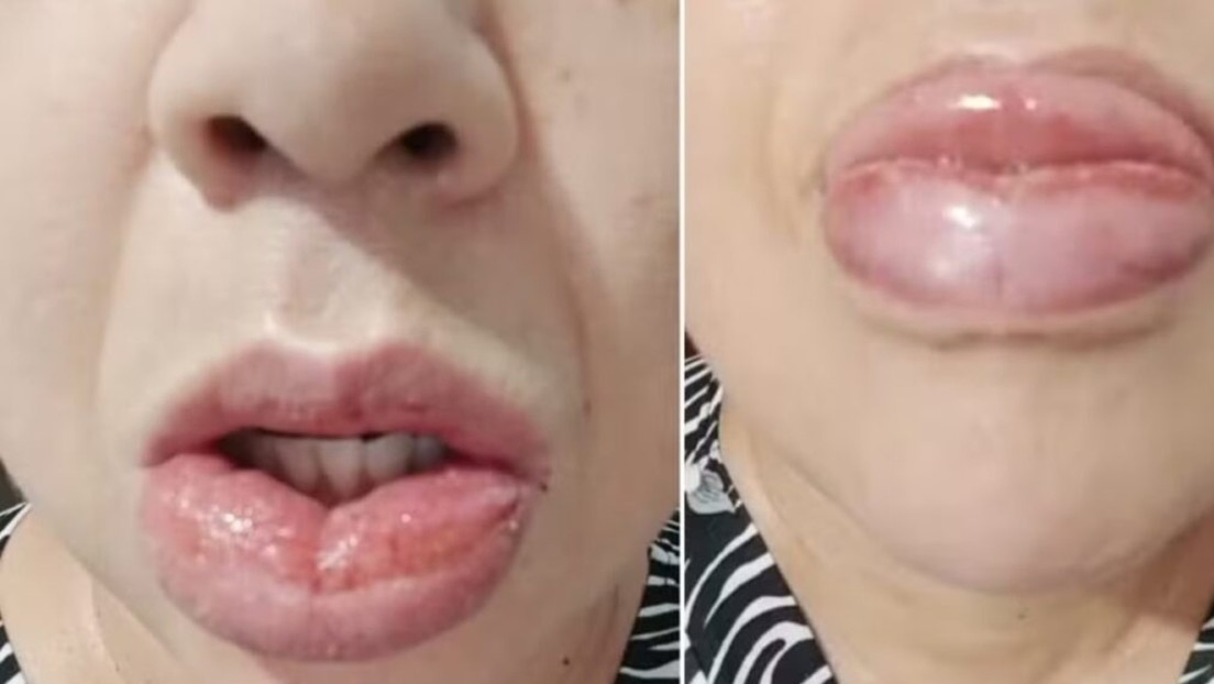 Dejarán de fabricar una conocida pasta dental después de miles de denuncias por reacciones adversas