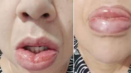 Dejarán de fabricar una conocida pasta dental después de miles de denuncias por reacciones adversas