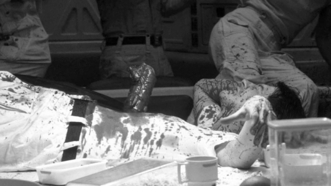 La brutal experiencia de un paciente que recuerda la escena más espeluznante de 'Alien'