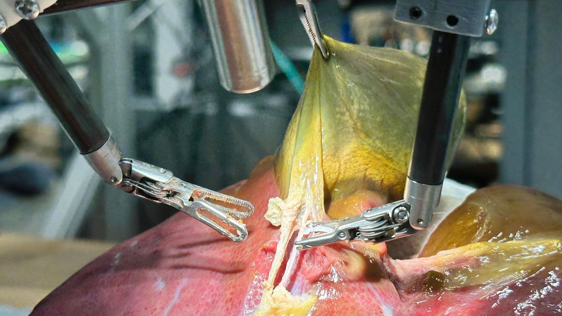 Avance histórico: un robot realiza por primera vez una cirugía realista sin ayuda humana