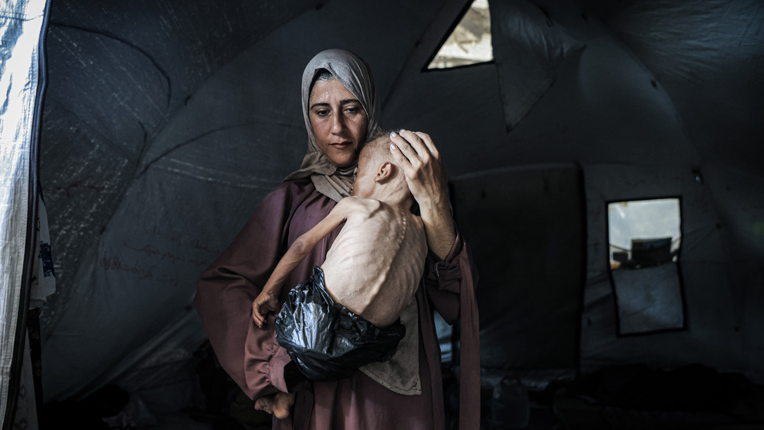 Imágenes que no querrán ver: así mueren de hambre en Gaza por el bloqueo de Israel