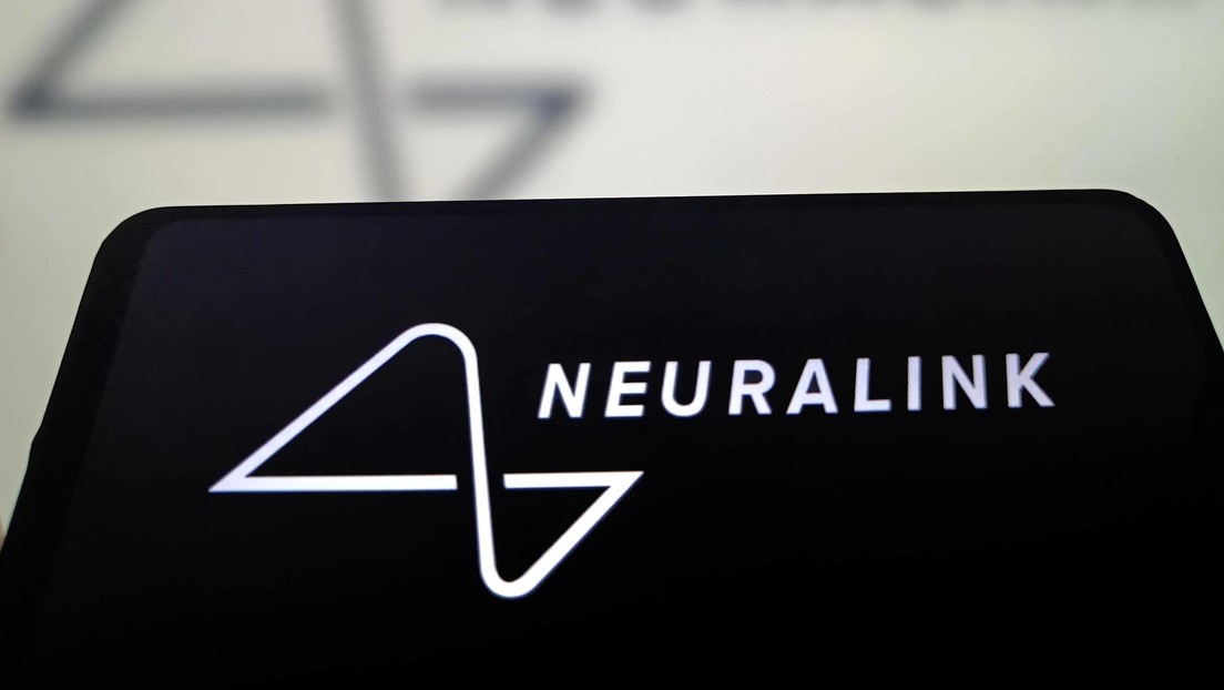 Mujer paralítica revela el impactante efecto del chip cerebral de Neuralink (VIDEO, FOTOS)