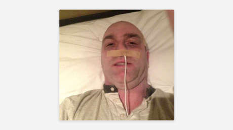 Exdeportista usa cable de iPhone para fingir que tiene cáncer y estafar a miles de personas
