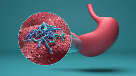 Identifican el principal factor del aumento de la incidencia del cáncer de estómago