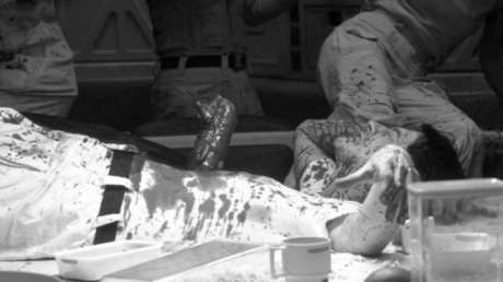 La brutal experiencia de un paciente que recuerda la escena más espeluznante de 'Alien'