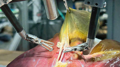 Avance histórico: un robot realiza por primera vez una cirugía realista sin ayuda humana