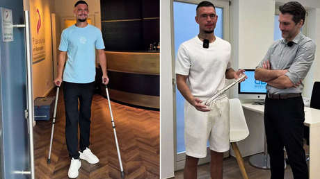 Rotura de piernas: el doloroso procedimiento de un 'influencer' para ganar altura