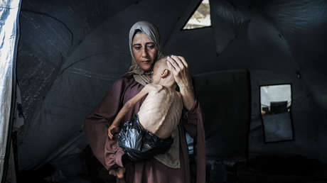 Imágenes que no querrán ver: así mueren de hambre en Gaza por el bloqueo de Israel